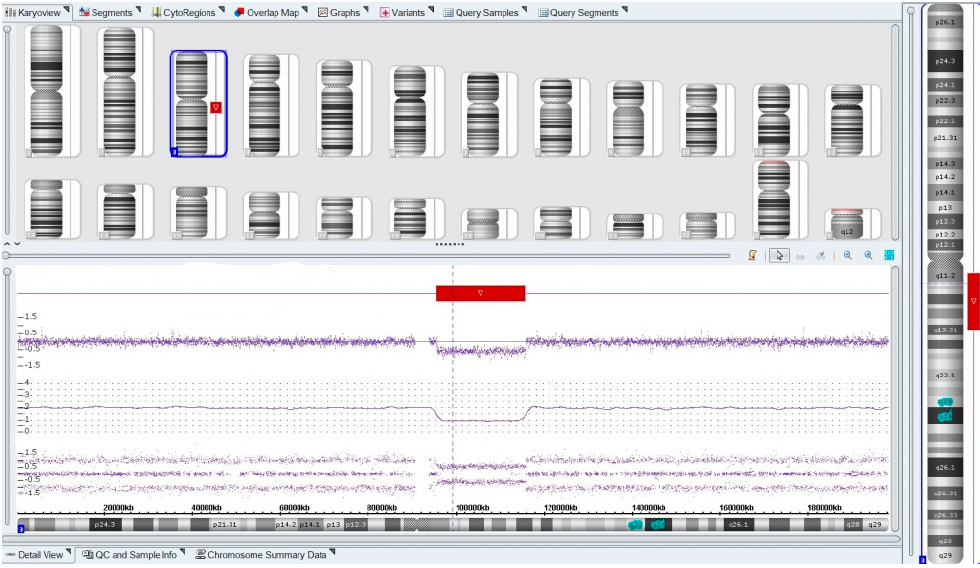 результаты работы программного обеспечения в программе ChAS