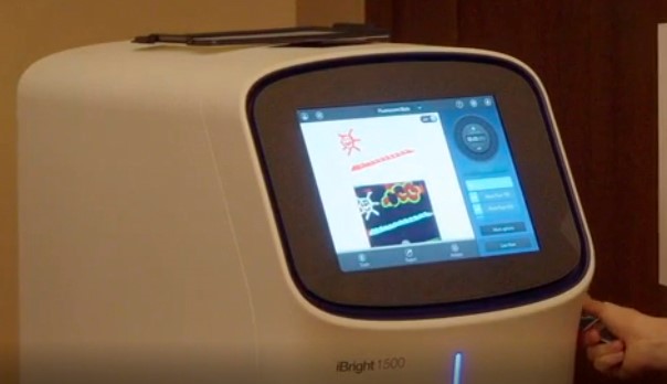 Дисплей прибора iBright