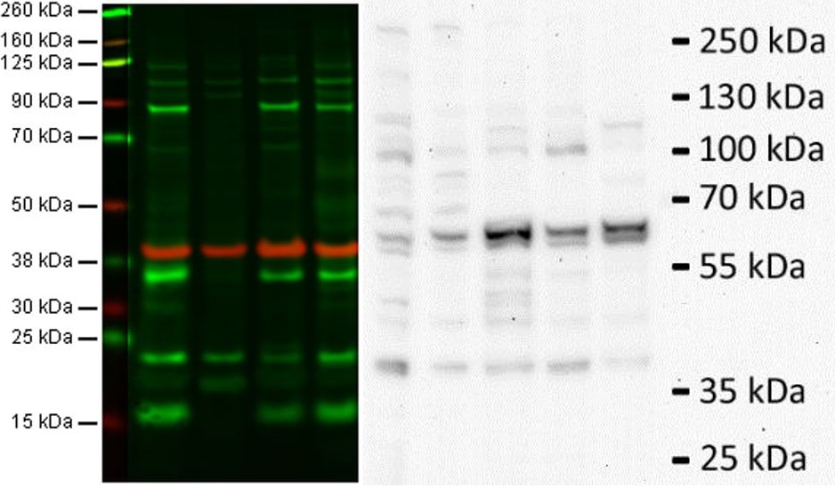 blotting-dializ-probopodgotovka-vebinary-dia-m-ru-2.jpg