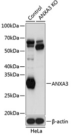 Антитела [KO Validated] ANXA3 кроличьи, поликлональные