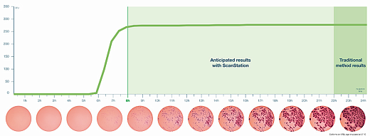 Станция автоматического инкубирования, размер колоний от 0,05 мм, со встроенным инкубатором, в режиме реального времени, ScanStation 200 Фото 3