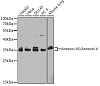 Антитела [KO Validated] Annexin A5/Annexin V кроличьи, поликлональные