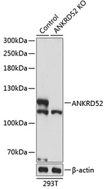 Антитела [KO Validated] ANKRD52 кроличьи, поликлональные